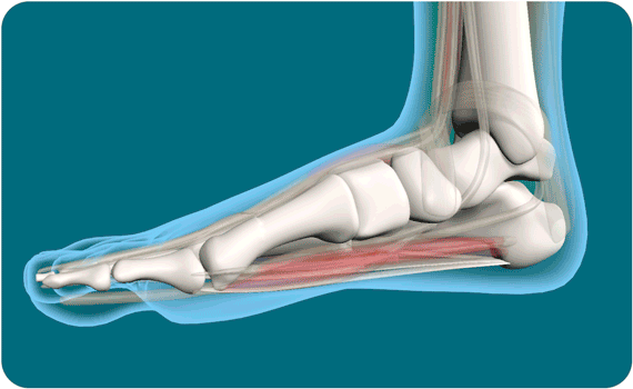 TÌM HIỂU VỀ BỆNH LÝ BÀN CHÂN BẸT TRẺ EM